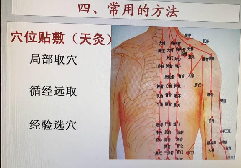 房檐上的大葱猜一生肖，详细解答、精准解答解释落实